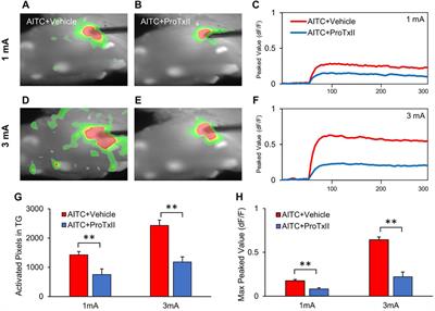 Inhibition of the Nav1.7 Channel in the Trigeminal Ganglion Relieves Pulpitis Inflammatory Pain